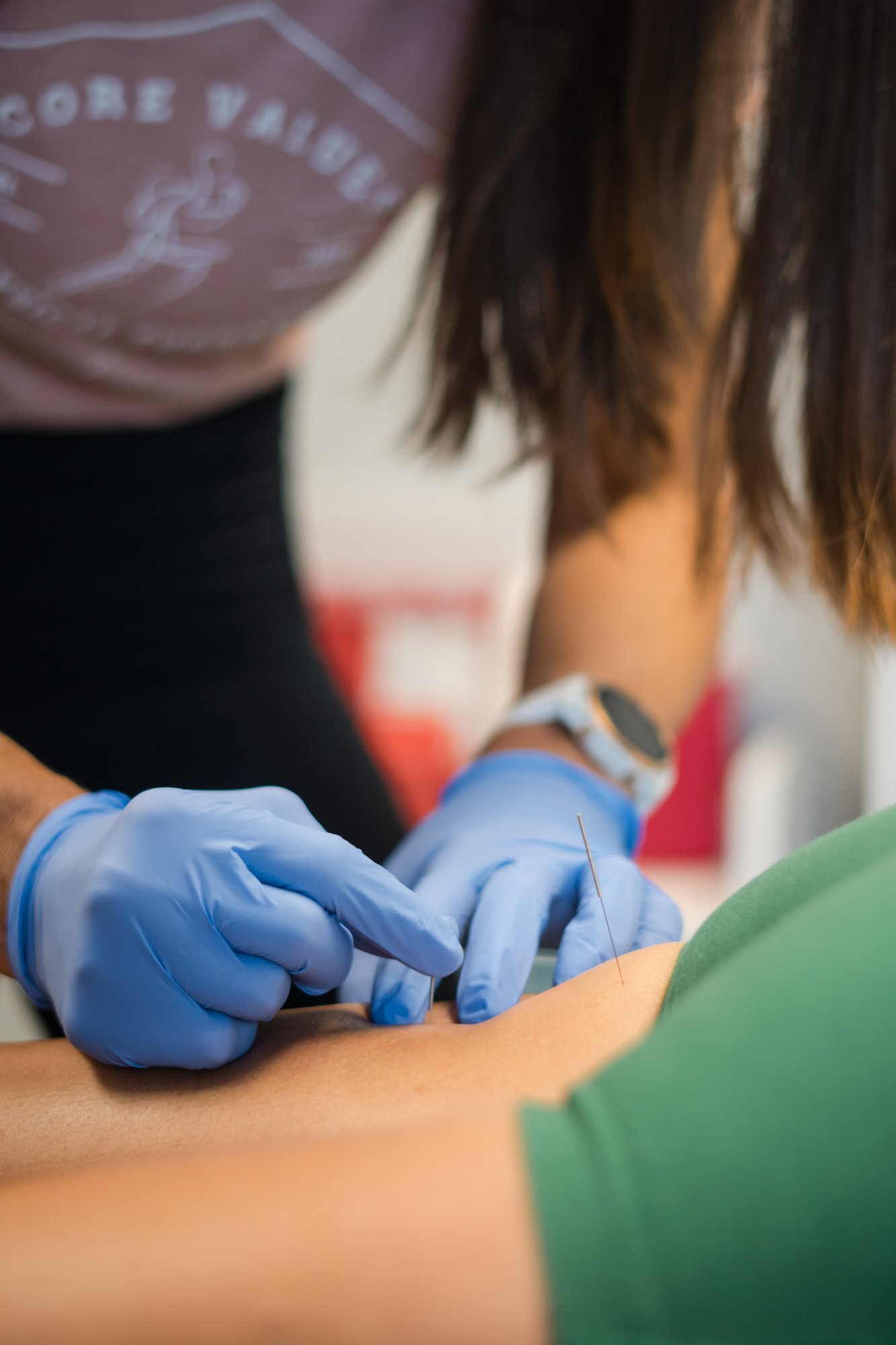 Core Values PT therapist treating runner with dry needling for muscle recovery in Lake Nona Core Values PT therapist treating runner with dry needling for muscle recovery in Lake Nona