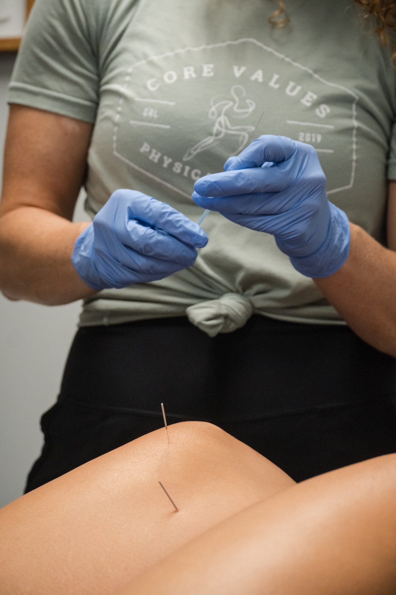 Lake Nona athlete receiving dry needling treatment for sports injury at Core Values Physical Therapy Lake Nona athlete receiving dry needling treatment for sports injury at Core Values Physical Therapy