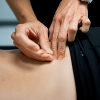 dry needling physical therapy
